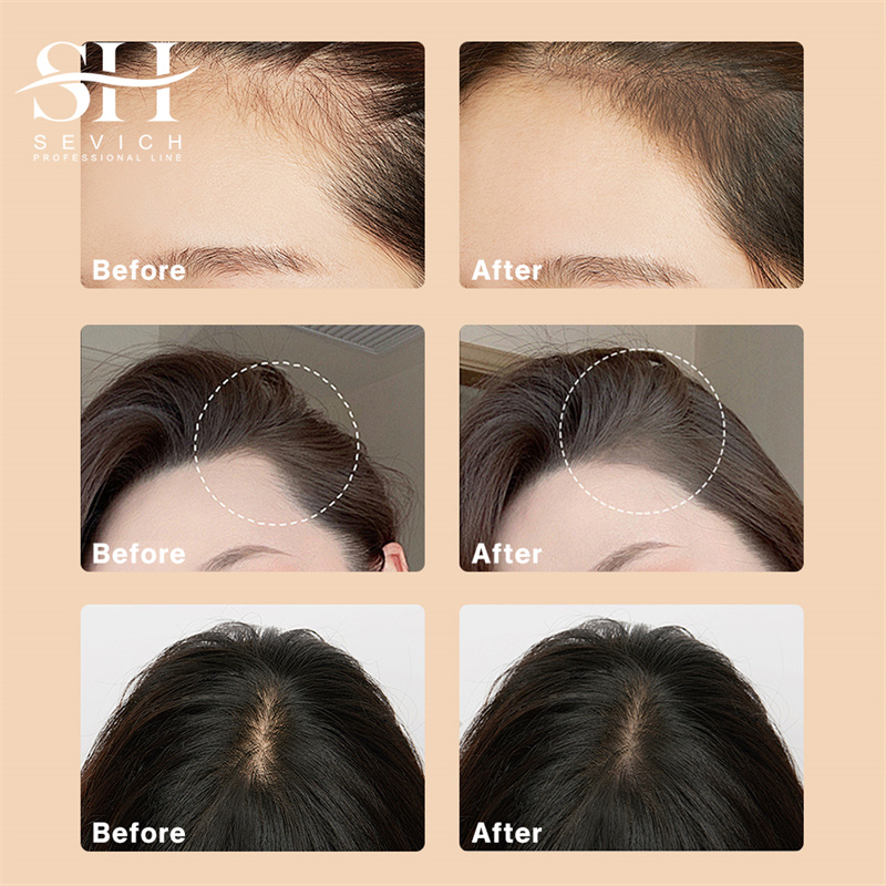 Hairline Shadow Powder Black R - Rooting Hormone Powder 评论和价格